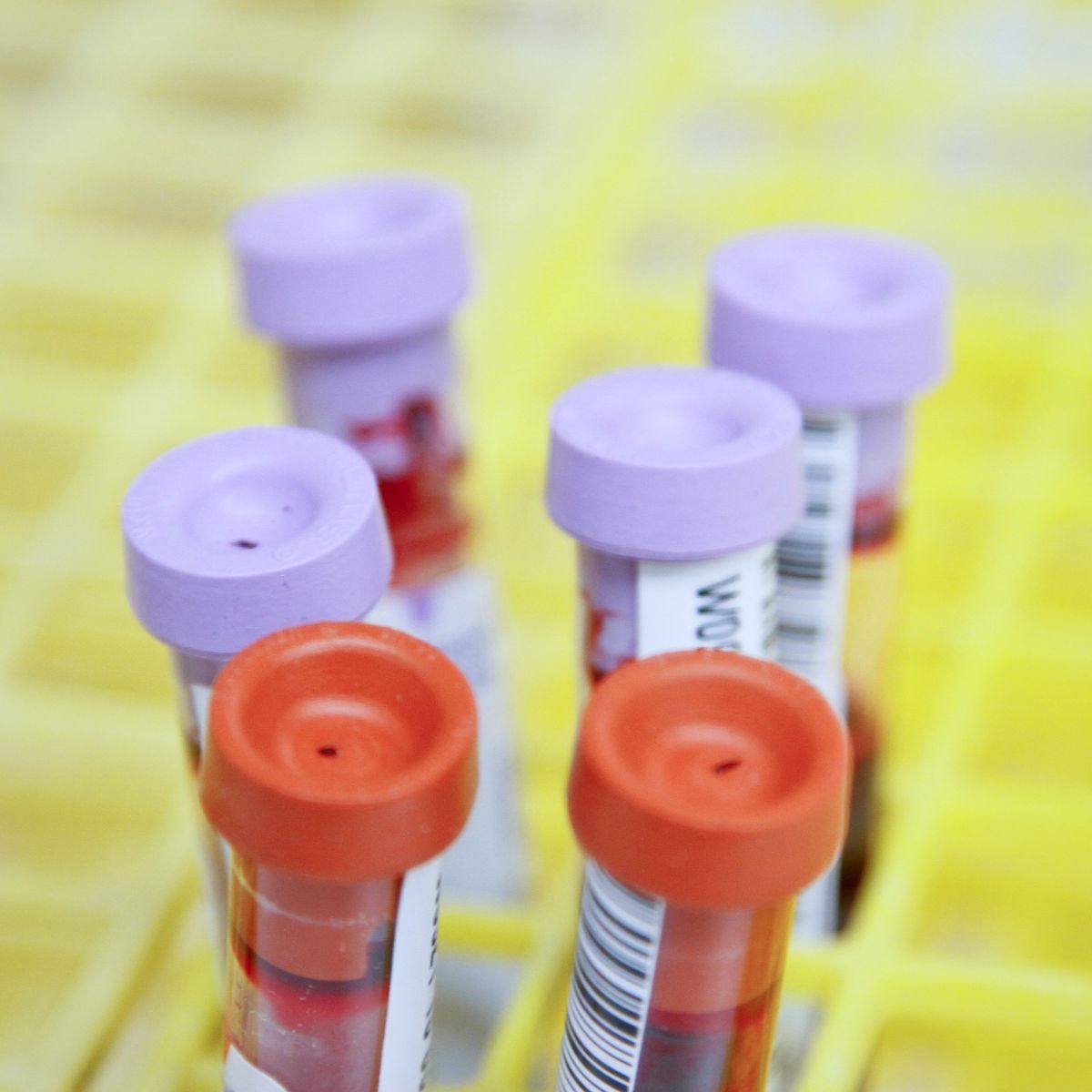 6 Perbedaan Rapid Test dan PCR Swab dan Bagaimana Prosedurnya